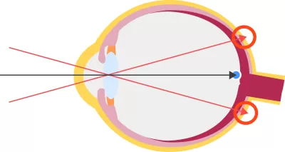 an illustration of PHD